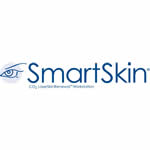 SmartSkin