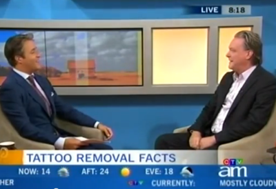 Toronto Laser Tattoo Removal