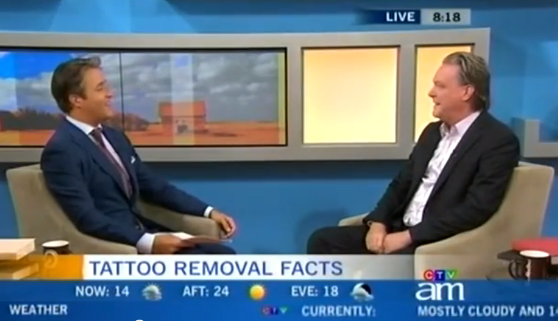 Toronto Laser Tattoo Removal