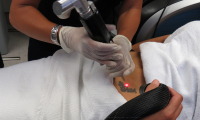 If you have tattoo regret, do your research before getting your tattoo removed